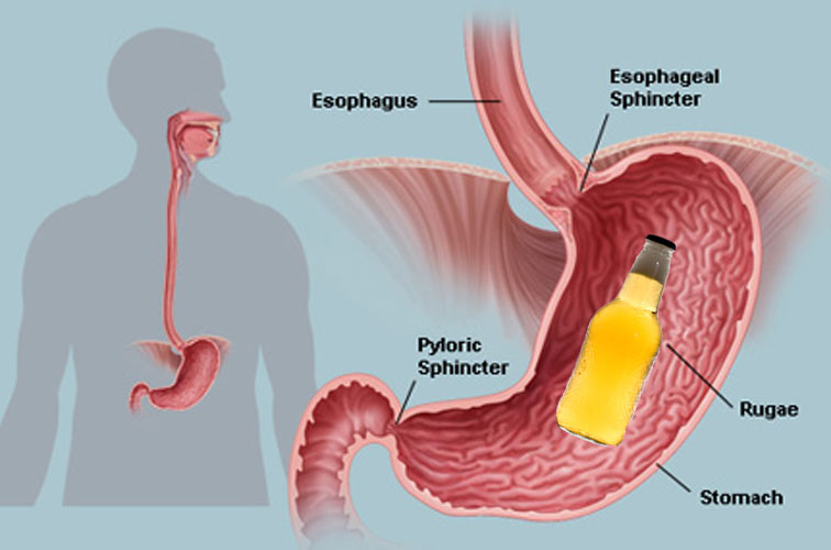 the stomach1 Motor16